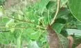 Hruka choroba 
